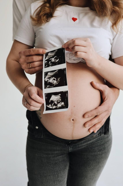 "Тридцать часов рожала мертвого сына": в чем винят врачей из Калининграда